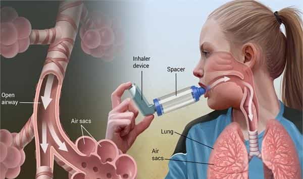 Home remedies asthma | अस्थमा के घरेलू उपचार
