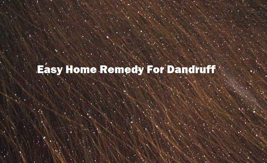 Easy Home Remedy For Dandruff