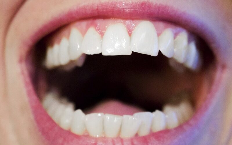 Free adult teeth closeup image, public domain CC0 photo.